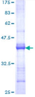 SDS PAGE (DMBT1-2700H).jpg
